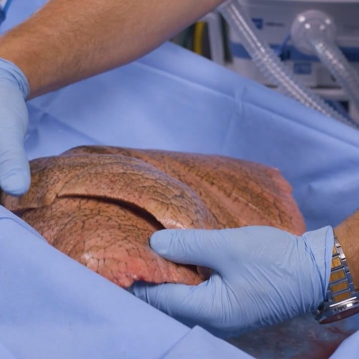 Volara + Indiana Donor Network